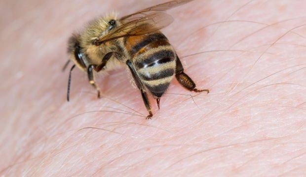 Arı alerjisi nedir ve belirtileri neledir? Arı sokmasına iyi gelen doğal yöntemler