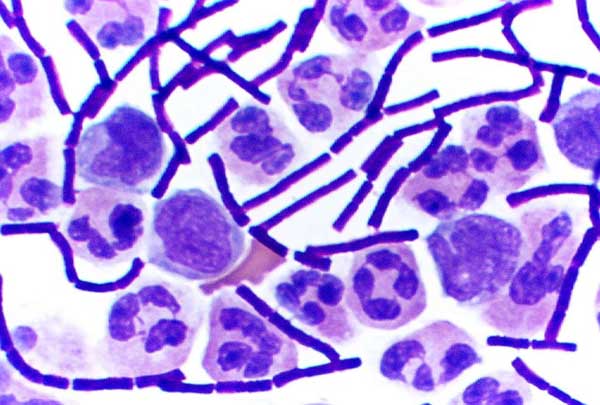 Gram_Stain_Anthrax.jpg