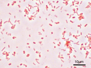 300px-Salmonella_Typhimurium_Gram.jpg