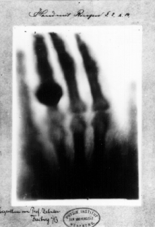220px-First_medical_X-ray_by_Wilhelm_R%C3%B6ntgen_of_his_wife_Anna_Bertha_Ludwig%27s_hand_-_18951222.gif