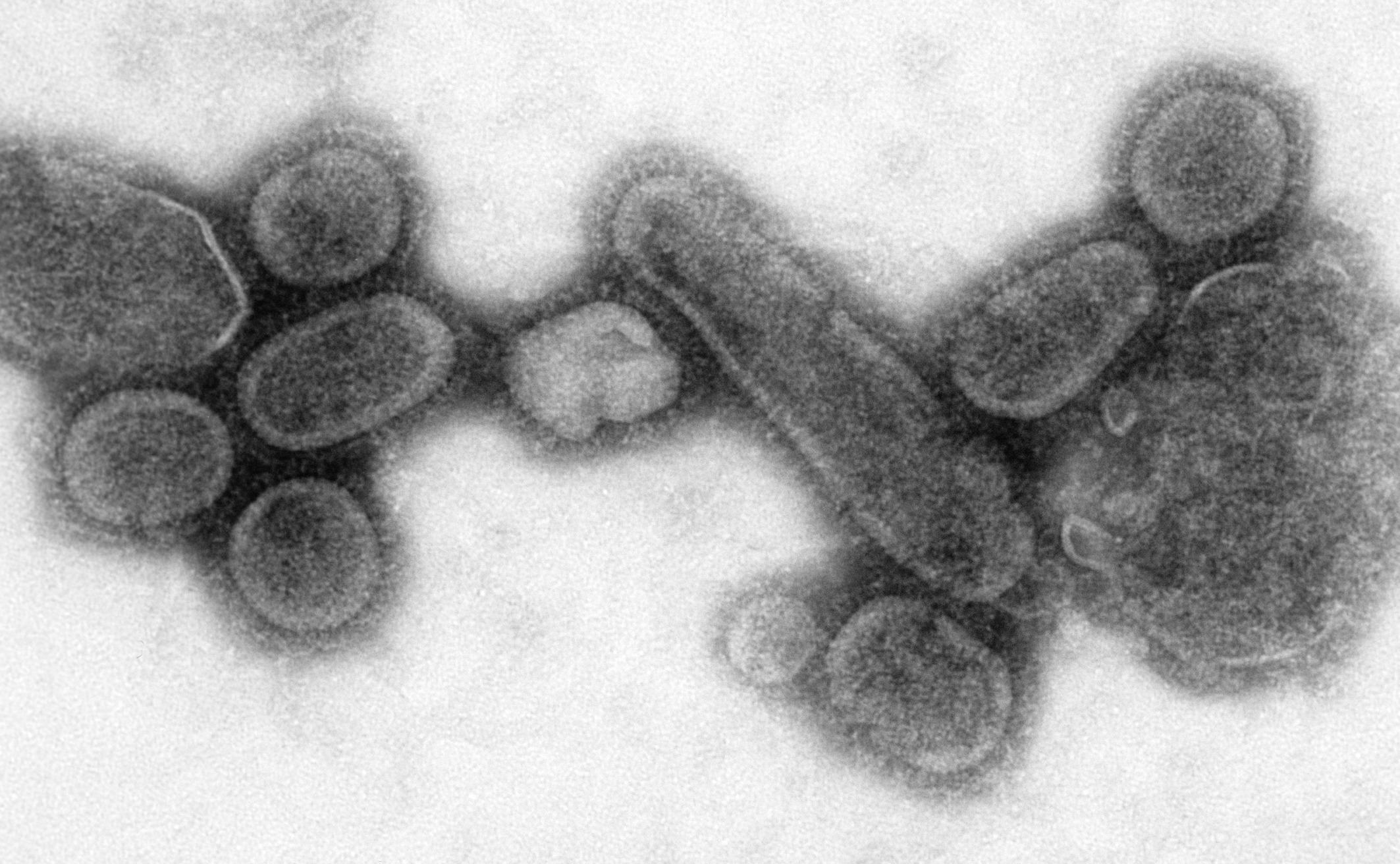 Reconstructed_Spanish_Flu_Virus.jpg
