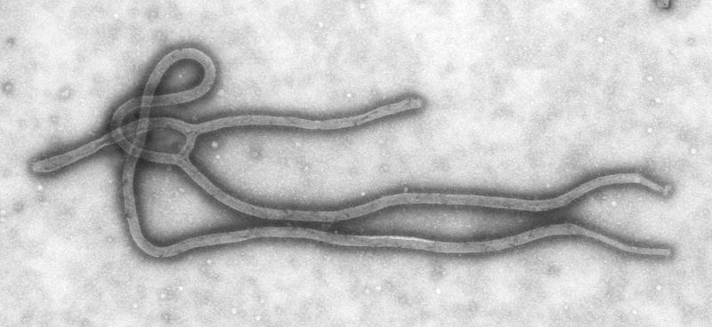 800px-Ebola_Virus_TEM_PHIL_1832_lores.jpg