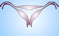 arcuat-uterus.jpg